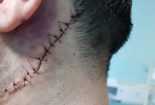 حمله به یک پزشک در نجف آباد